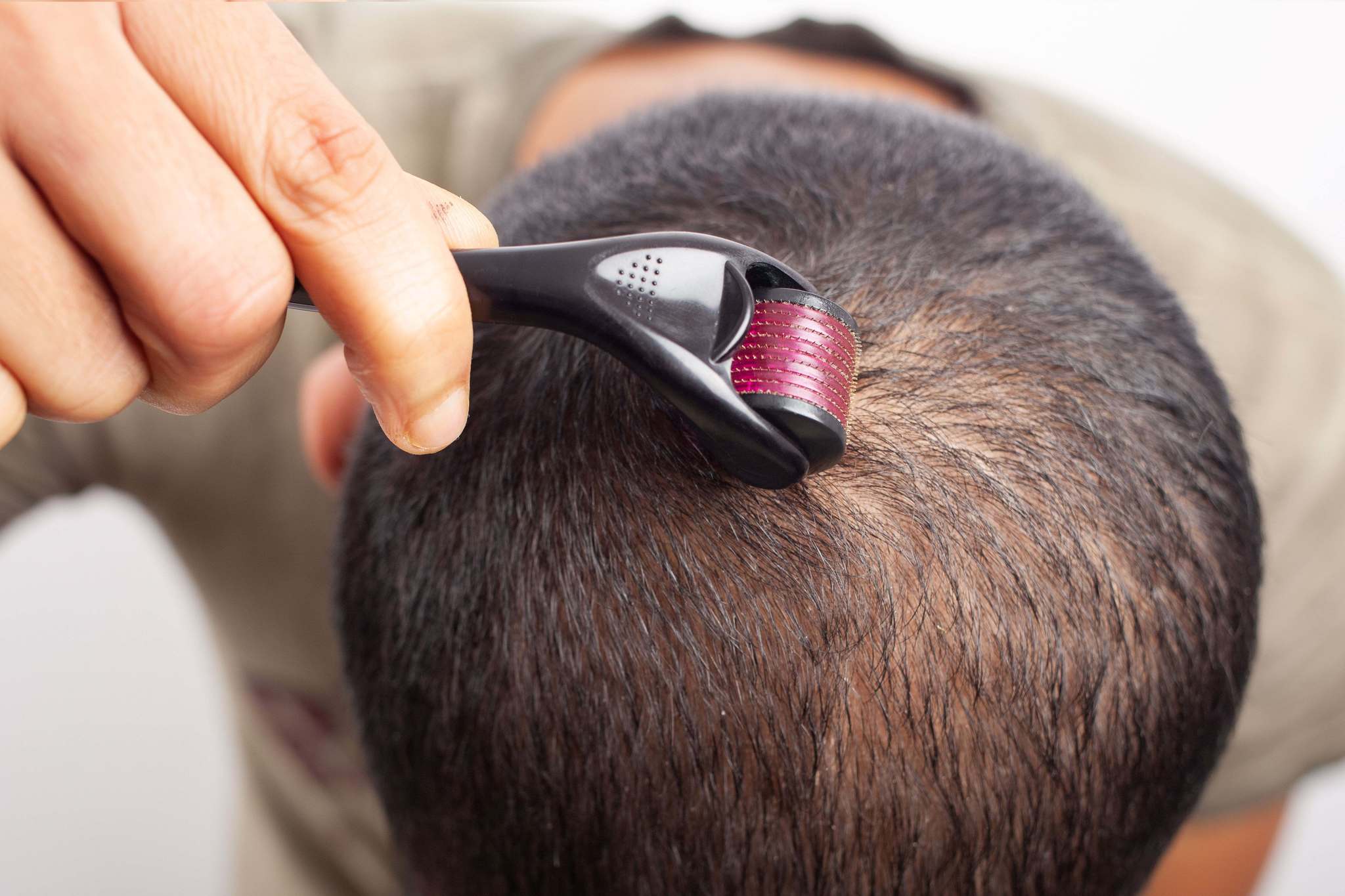 Derma Roller - الصورة 4
